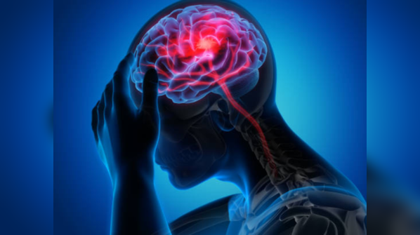 FAST: Stroke signs