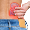 ​​Polycystic Kidney Disease (PKD)​