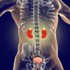 ​​What are the risk factors?​