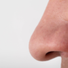Fleshy nose