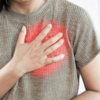 ​Pericarditis​