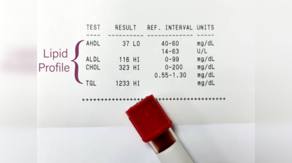 Triglycerides do not matter