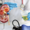​​Renal function test​