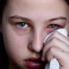 ​Pain in the eyes​