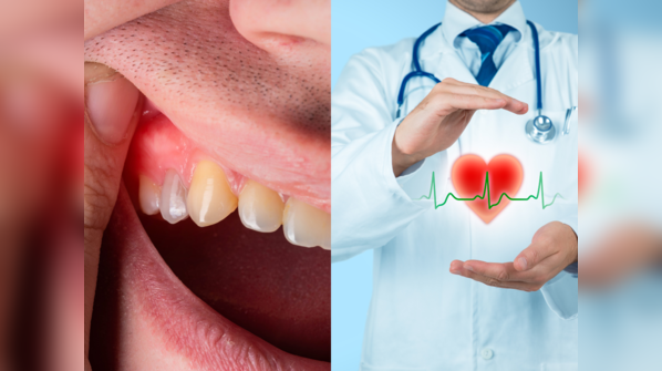 Gum disease is linked to heart problems