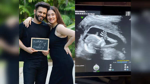 The couple’s pregnancy announcement
