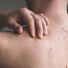 ​Why you should inform your doctor about the pain?​