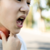 ​​Neurological Symptoms​