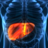 ​Know about hourglass syndrome​