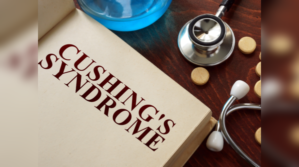 Cushing’s syndrome