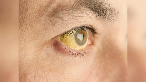 Tell-tale signs to watch out for