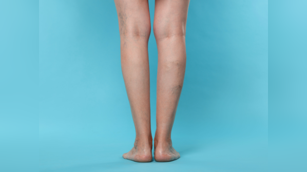 What does this new symptom entail?