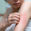 ​​Precautionary actions for skin health​