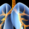 Article image for: Pulmonary embolism
