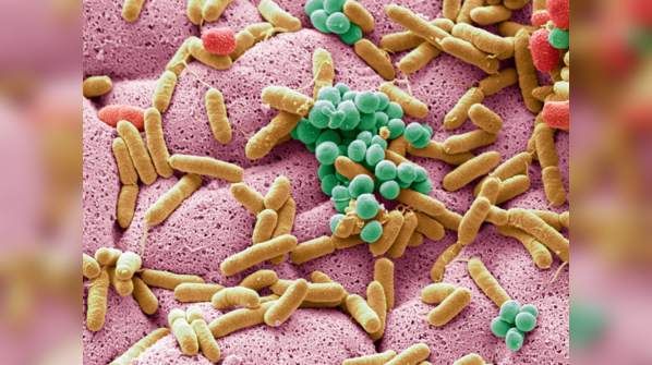 What is Listeria infection?
