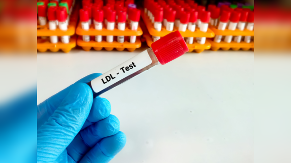 Risk factors for high LDL are