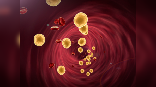 What is bad cholesterol?