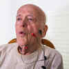 Early warning signs of stroke