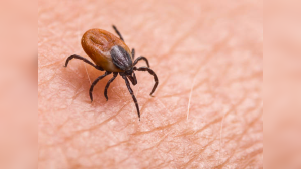 Lyme disease has more than 300 symptoms