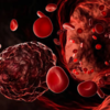 ​Myth: Blood cancer always causes visible symptoms​