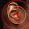 ​Complications to know​