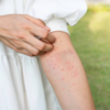 ​The major symptoms of this disease are