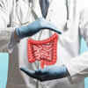 ​What is colorectal cancer?