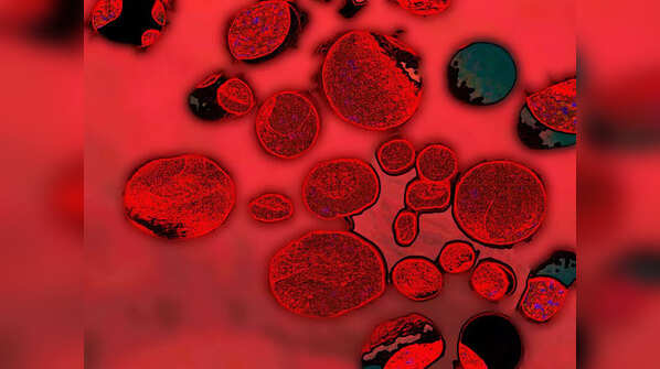 High blood sugar can damage blood vessels