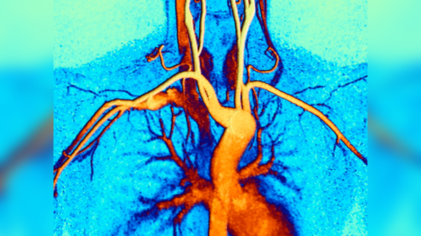 Cardiac Magnetic Resonance Imaging (MRI)