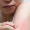 Article image for: Anti-inflammatory