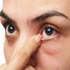 ​When to see a doctor​