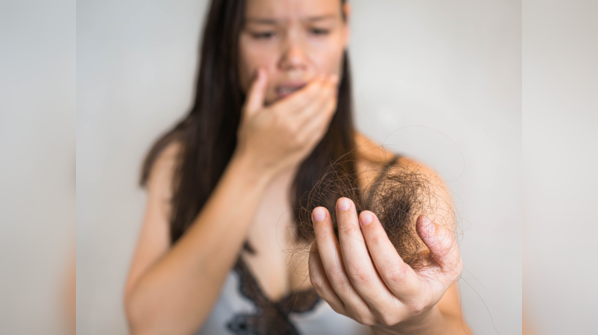 I had uncontrolled hair fall