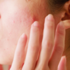​​My skin became dull​