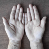 ​Pale skin​