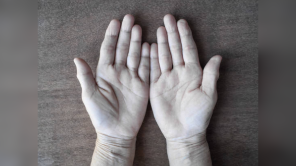 Pale skin