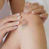 ​Unhealed bruise and wounds