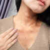 ​Dark neck creases 