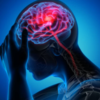 ​How to prevent stroke?​