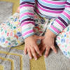 ​​Risk of Dysplasia​