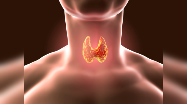 Complications associated with thyroid cancer