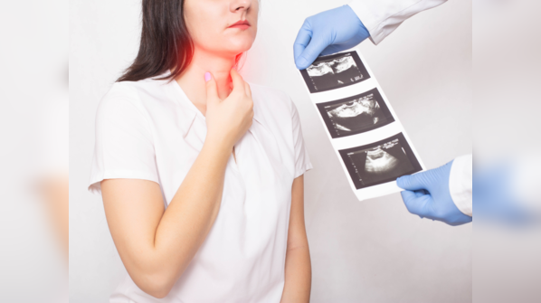 Treatment of thyroid cancer