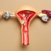 ​​Early symptoms of vaginal cancer​