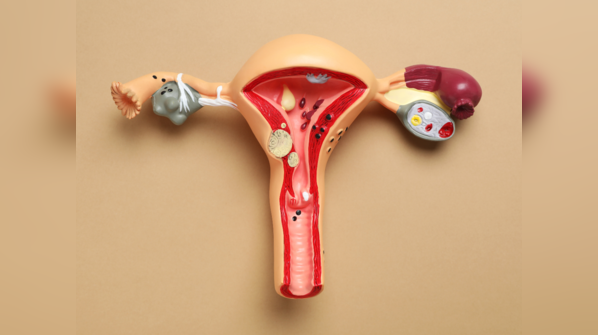 Early symptoms of vaginal cancer