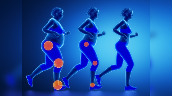 Obesity is the latest pandemic