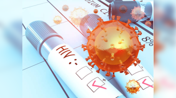 HIV and AIDS are different