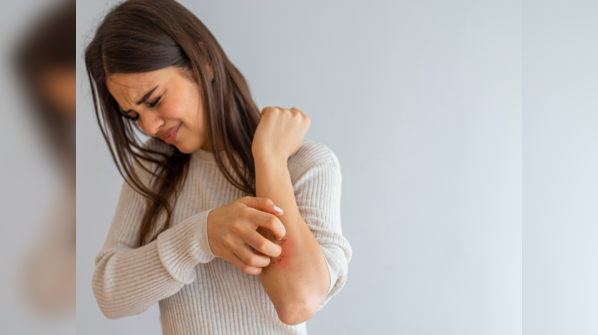 Impact of vitamin deficiencies on skin