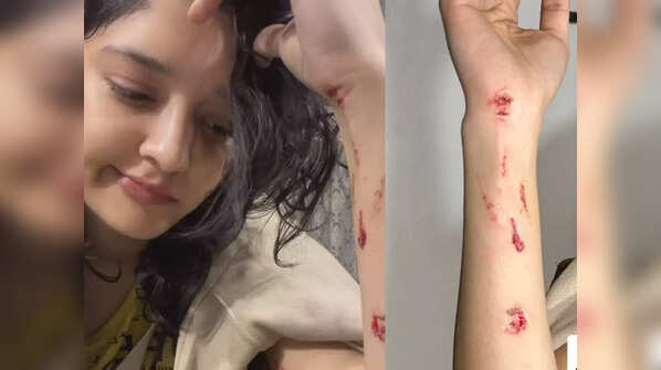 Ritika Singh was injured at the 'Thalaivar 170' set.