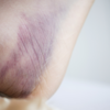 ​​Underlying health issues​
