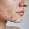 ​​Skin problems​