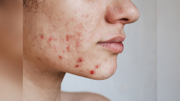 Skin problems